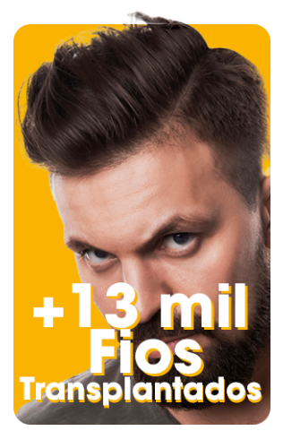 +13 mil fios transplantados Imagem de um homem branco com cabelos e barbas castanhos com camiseta cinza