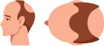 Tipo 5